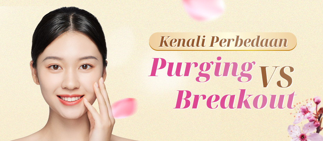 KENALI PERBEDAAN PURGING VS BREAKOUT